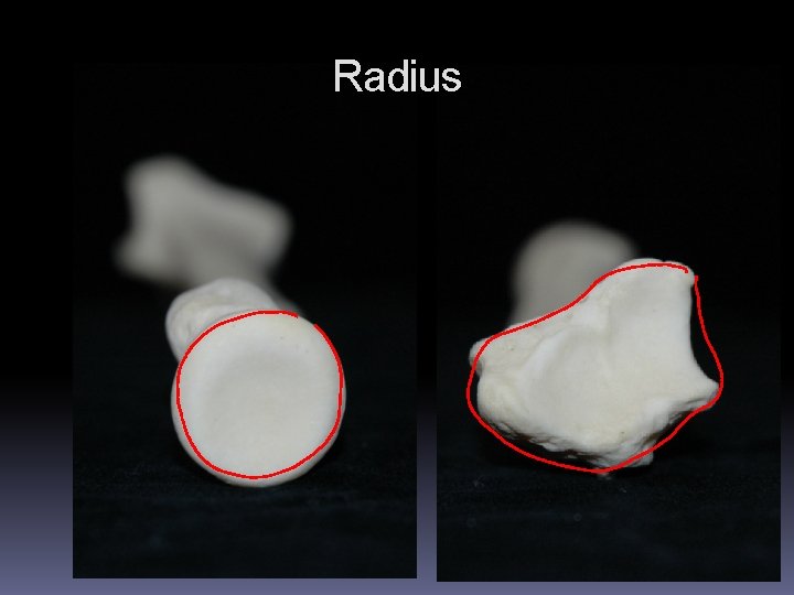 Radius 