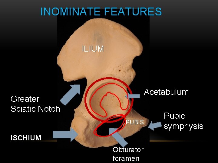 INOMINATE FEATURES ILIUM Acetabulum Greater Sciatic Notch PUBIS ISCHIUM Obturator foramen Pubic symphysis INOMINATE FEATURES ILIUM Acetabulum Greater Sciatic Notch PUBIS ISCHIUM Obturator foramen Pubic symphysis
