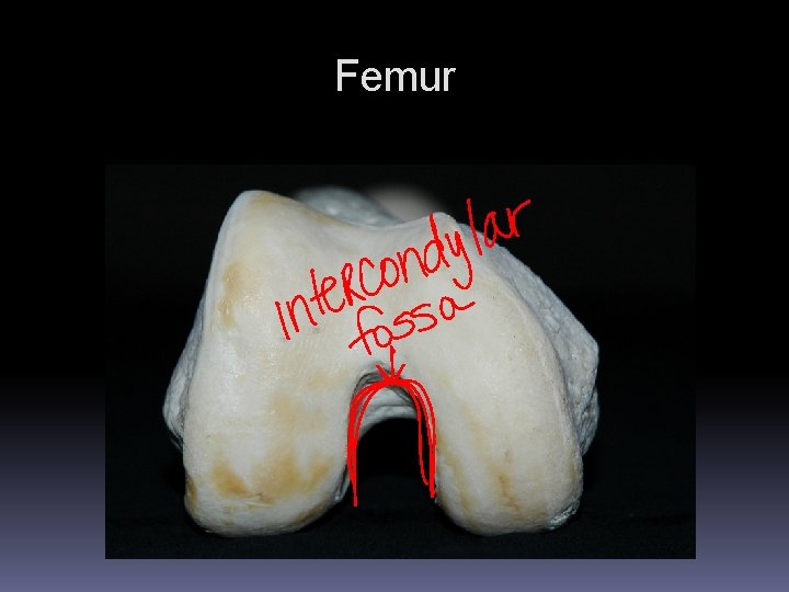 Femur Femur