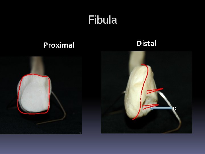 Fibula Proximal Distal D Fibula Proximal Distal D