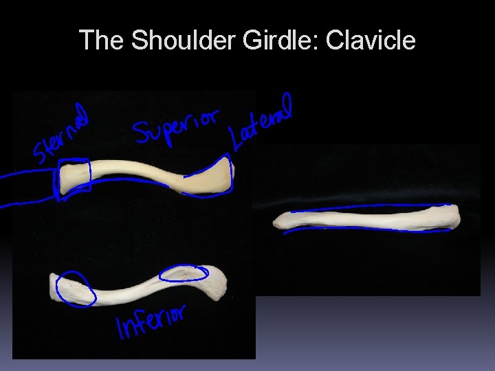The Shoulder Girdle: Clavicle The Shoulder Girdle: Clavicle