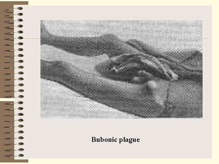 Bubonic plague 