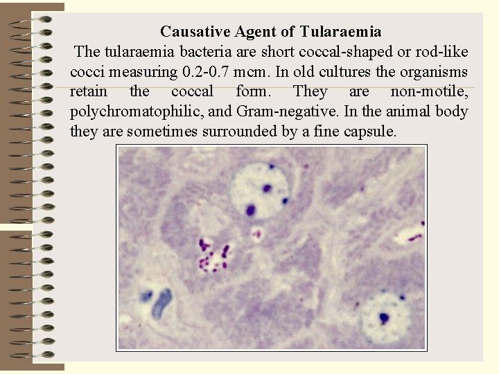 Causative Agent of Tularaemia The tularaemia bacteria are short coccal-shaped or rod-like cocci measuring