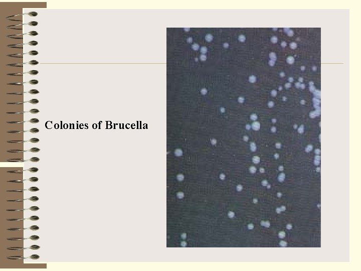 Colonies of Brucella 