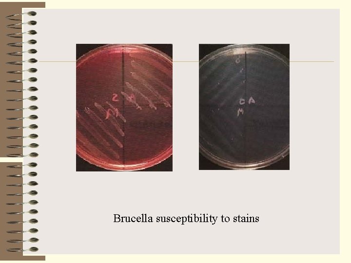 Brucella susceptibility to stains 