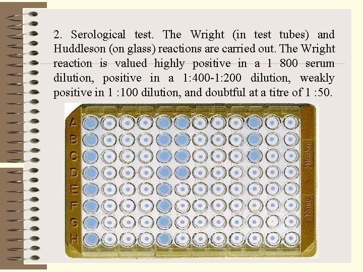 2. Serological test. The Wright (in test tubes) and Huddleson (on glass) reactions are