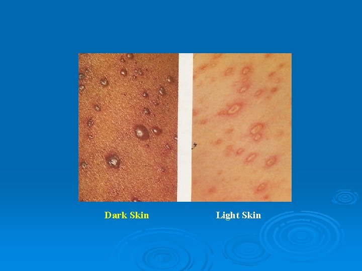 Dark Skin Light Skin 