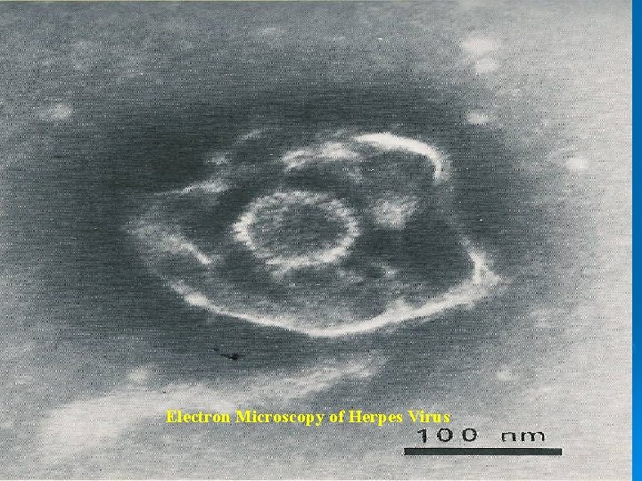 Electron Microscopy of Herpes Virus 