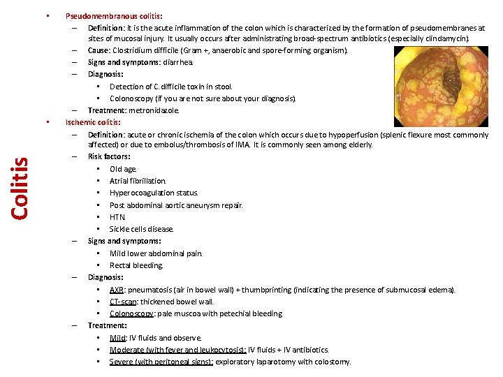  • Colitis • Pseudomembranous colitis: – Definition: it is the acute inflammation of