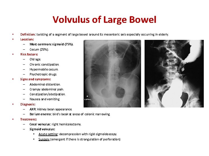 Volvulus of Large Bowel • • • Definition: Definition twisting of a segment of