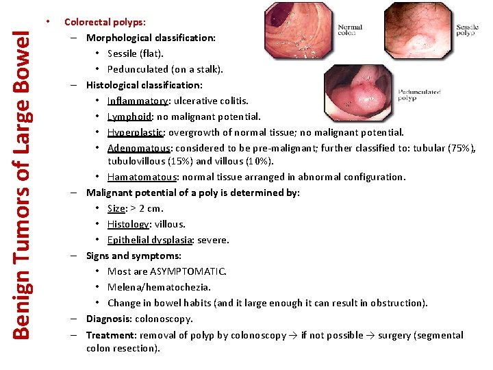 Benign Tumors of Large Bowel • Colorectal polyps: – Morphological classification: • Sessile (flat).