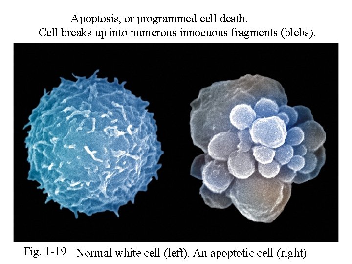 Apoptosis, or programmed cell death. Cell breaks up into numerous innocuous fragments (blebs). Fig.