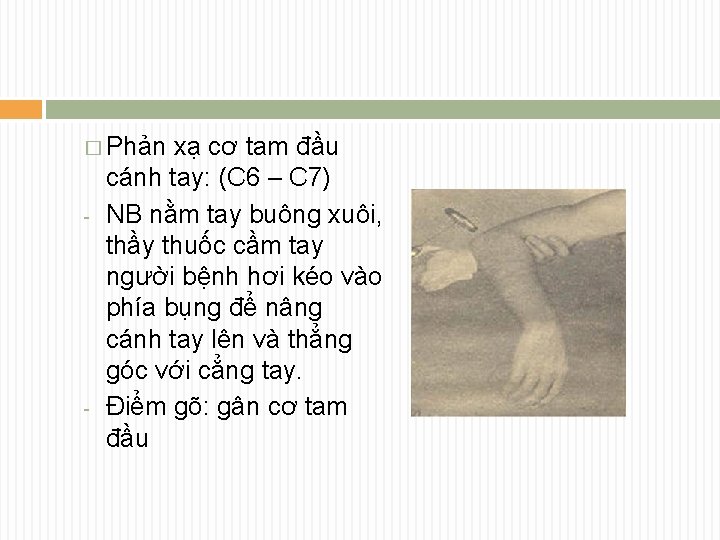 � Phản - - xạ cơ tam đầu cánh tay: (C 6 – C