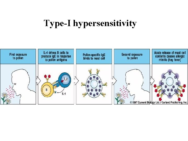 Type-I hypersensitivity 