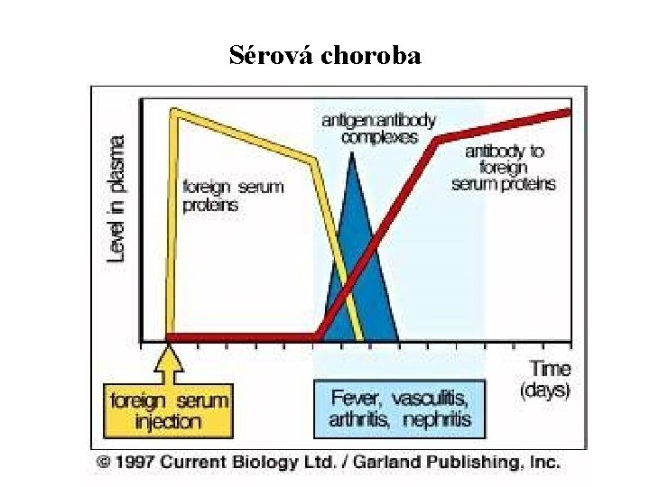 Sérová choroba 