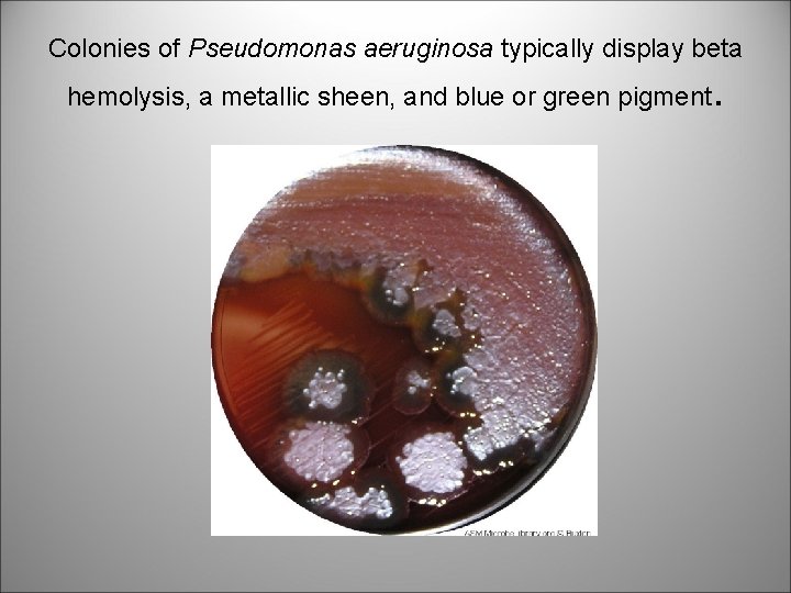 Colonies of Pseudomonas aeruginosa typically display beta hemolysis, a metallic sheen, and blue or