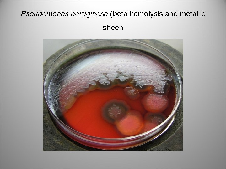 Pseudomonas aeruginosa (beta hemolysis and metallic sheen 