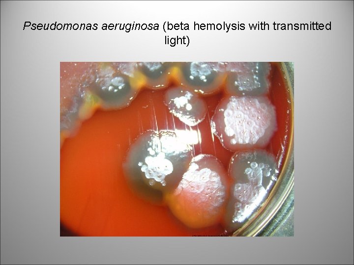 Pseudomonas aeruginosa (beta hemolysis with transmitted light) 