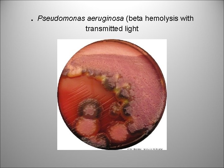 . Pseudomonas aeruginosa (beta hemolysis with transmitted light 