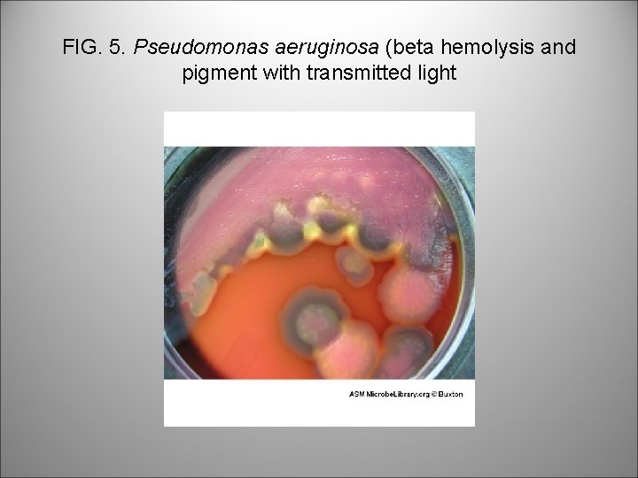 FIG. 5. Pseudomonas aeruginosa (beta hemolysis and pigment with transmitted light 