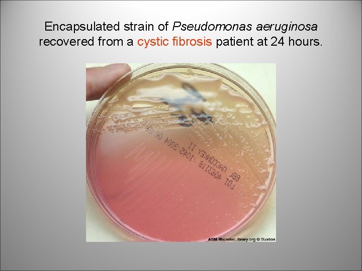Encapsulated strain of Pseudomonas aeruginosa recovered from a cystic fibrosis patient at 24 hours.