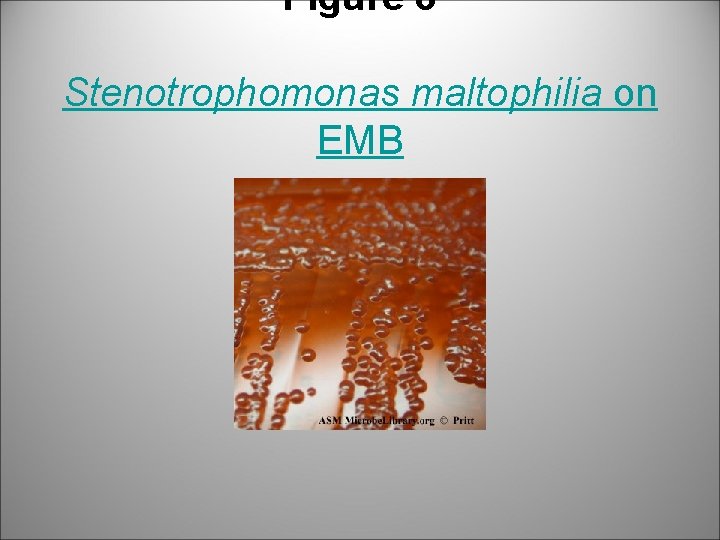Figure 8 Stenotrophomonas maltophilia on EMB 