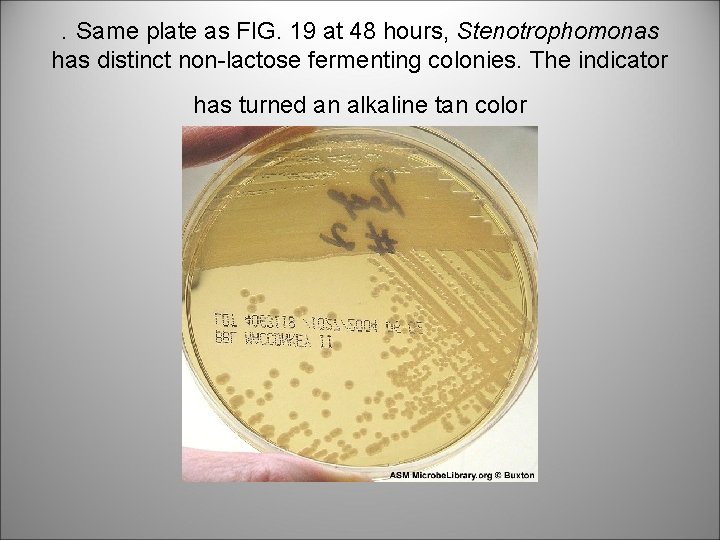 . Same plate as FIG. 19 at 48 hours, Stenotrophomonas has distinct non-lactose fermenting