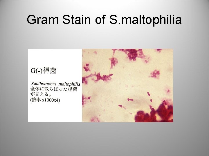 Gram Stain of S. maltophilia 