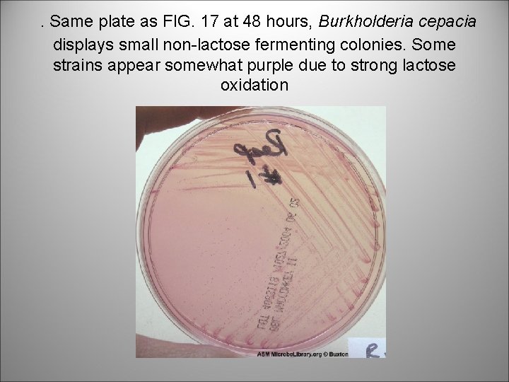 . Same plate as FIG. 17 at 48 hours, Burkholderia cepacia displays small non-lactose
