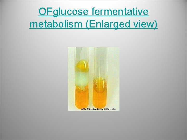 OFglucose fermentative metabolism (Enlarged view) 
