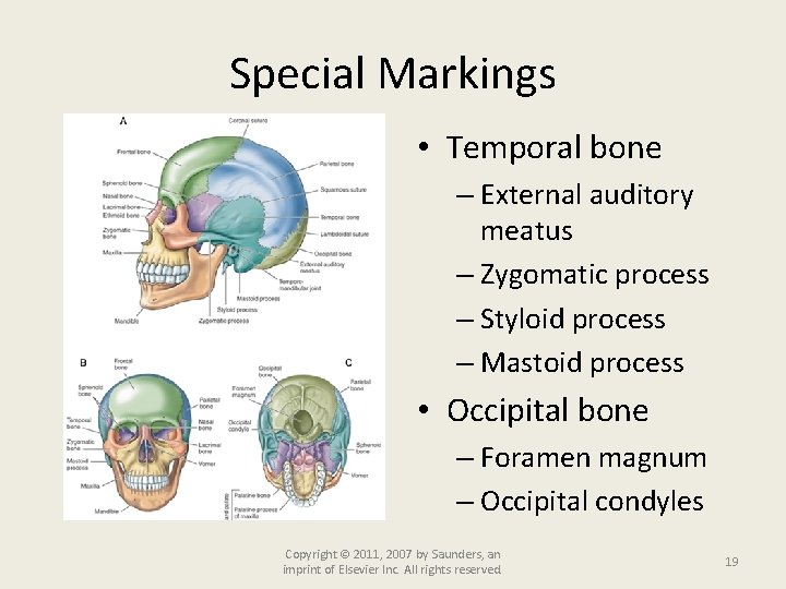 Special Markings • Temporal bone – External auditory meatus – Zygomatic process – Styloid