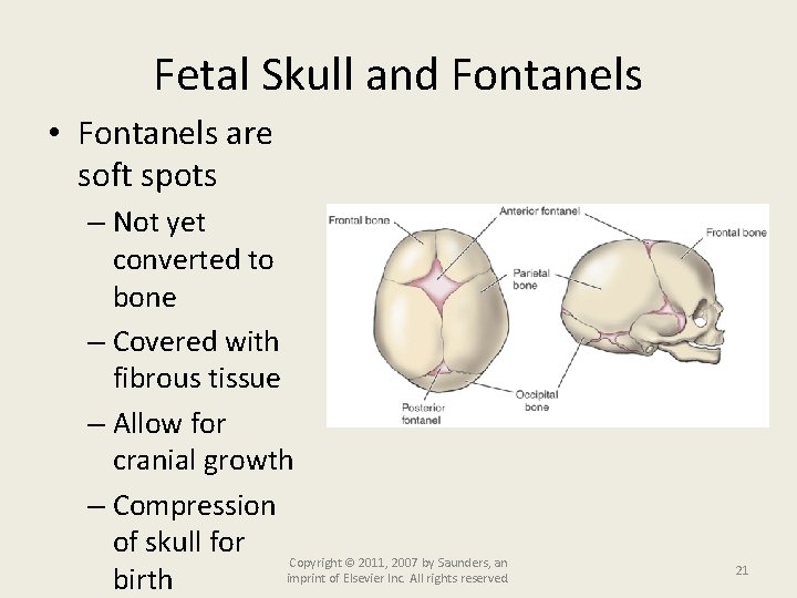 Fetal Skull and Fontanels • Fontanels are soft spots – Not yet converted to