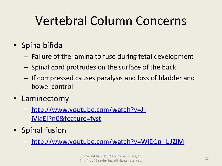 Vertebral Column Concerns • Spina bifida – Failure of the lamina to fuse during