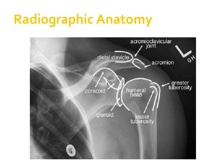 Radiographic Anatomy 