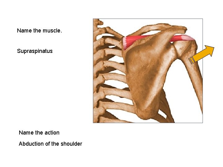 Name the muscle. Supraspinatus Name the action Abduction of the shoulder 