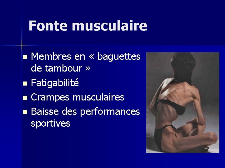 Fonte musculaire Membres en « baguettes de tambour » n Fatigabilité n Crampes musculaires