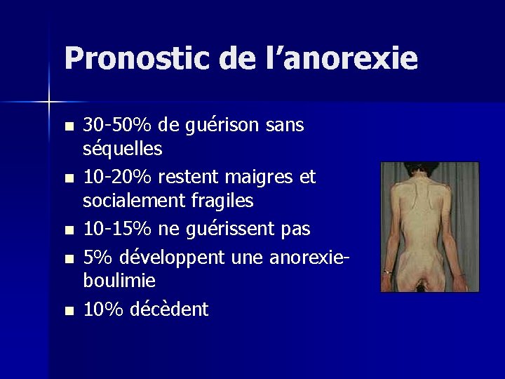 Pronostic de l’anorexie n n n 30 -50% de guérison sans séquelles 10 -20%