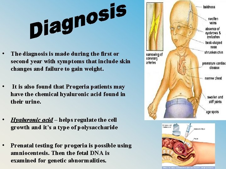  • The diagnosis is made during the first or second year with symptoms