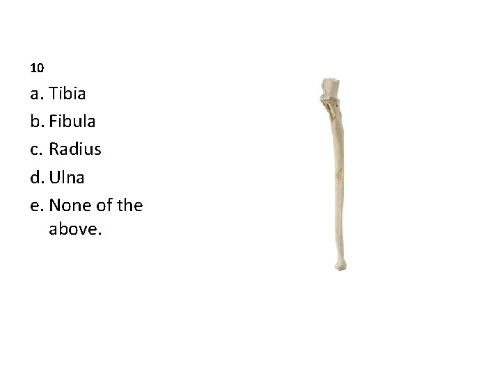 10 a. Tibia b. Fibula c. Radius d. Ulna e. None of the above.