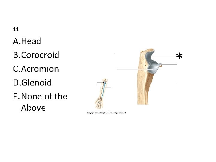 11 A. Head B. Corocroid C. Acromion D. Glenoid E. None of the Above