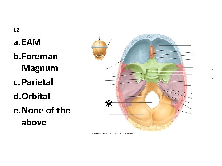 12 a. EAM b. Foreman Magnum c. Parietal d. Orbital e. None of the