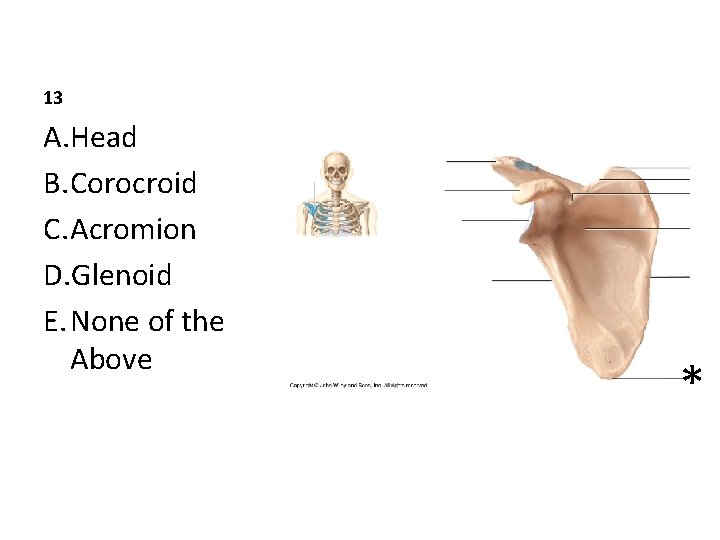 13 A. Head B. Corocroid C. Acromion D. Glenoid E. None of the Above