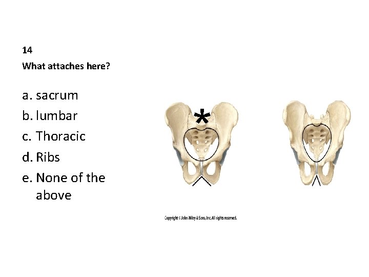 14 What attaches here? a. sacrum b. lumbar c. Thoracic d. Ribs e. None