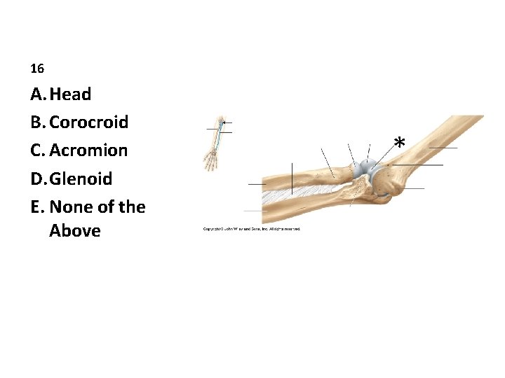 16 A. Head B. Corocroid C. Acromion D. Glenoid E. None of the Above