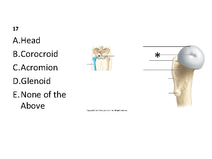 17 A. Head B. Corocroid C. Acromion D. Glenoid E. None of the Above