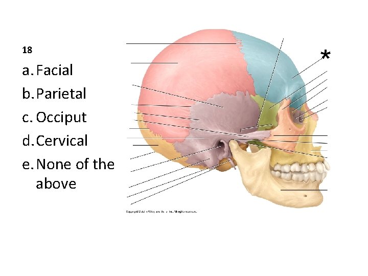 18 a. Facial b. Parietal c. Occiput d. Cervical e. None of the above