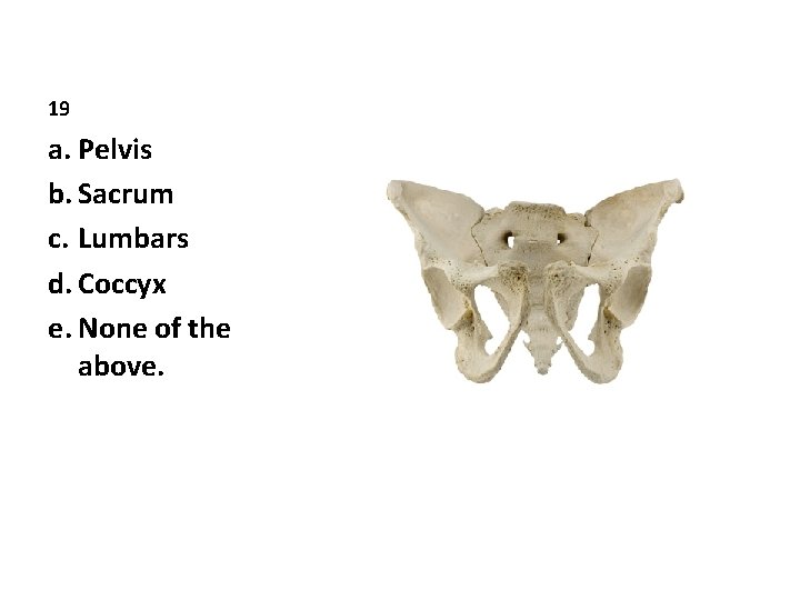 19 a. Pelvis b. Sacrum c. Lumbars d. Coccyx e. None of the above.