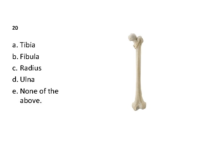 20 a. Tibia b. Fibula c. Radius d. Ulna e. None of the above.