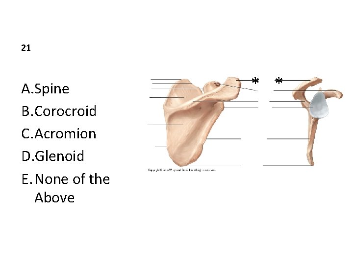 21 A. Spine B. Corocroid C. Acromion D. Glenoid E. None of the Above
