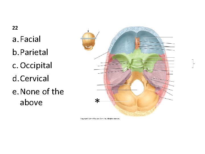 22 a. Facial b. Parietal c. Occipital d. Cervical e. None of the above